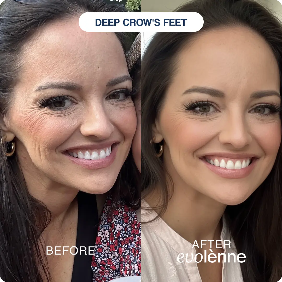 PeptiGlow™ Infusion System