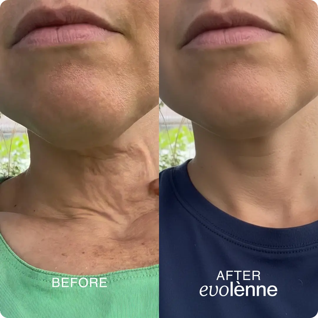 PeptiGlow™ Infusion System