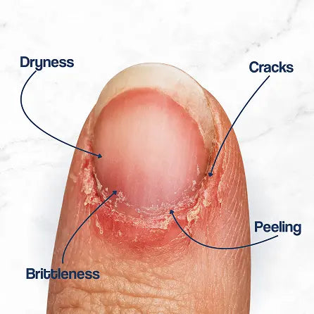 Cuticle Care+