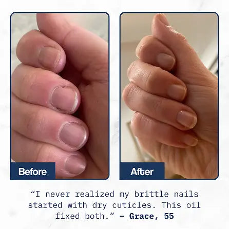 Cuticle Care+