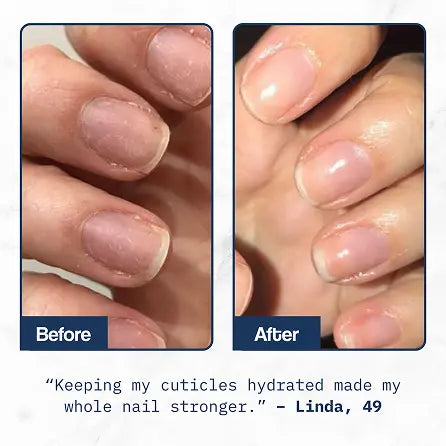 Cuticle Care+