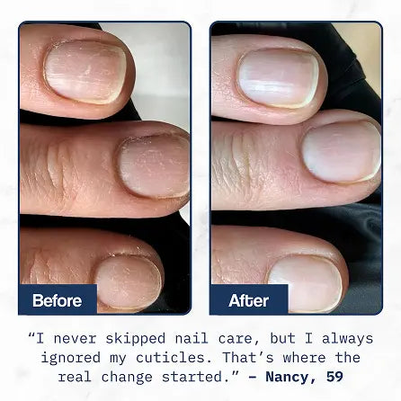 Cuticle Care+