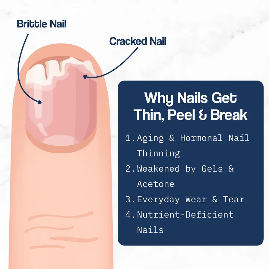 NailGuard Pro