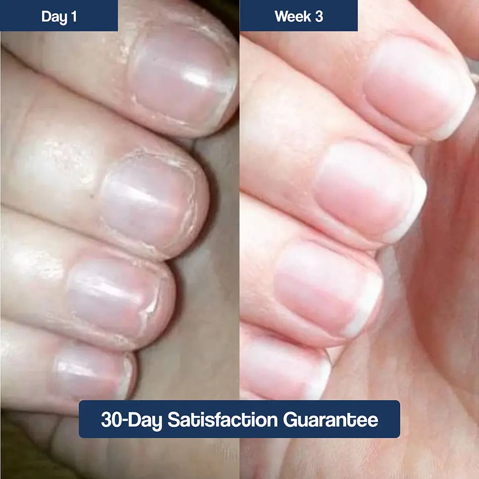Dual Defense Nail System