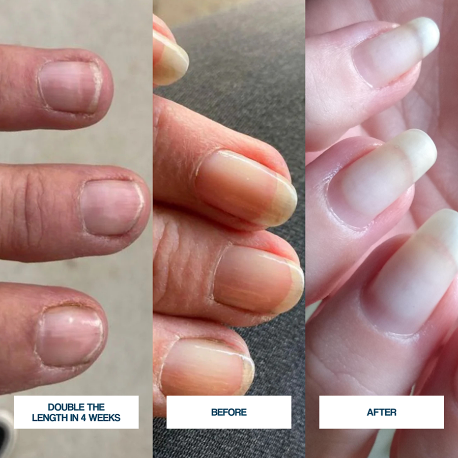 NailRenew Prime Nail Serum with DualPeptide Formula™ (CC)