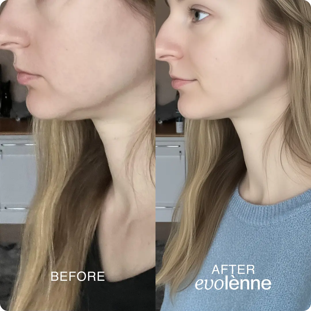 PeptiGlow™ Infusion System