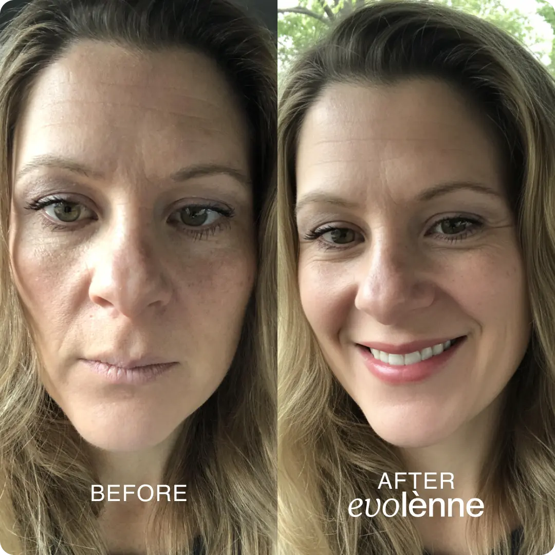 PeptiGlow™ Infusion System