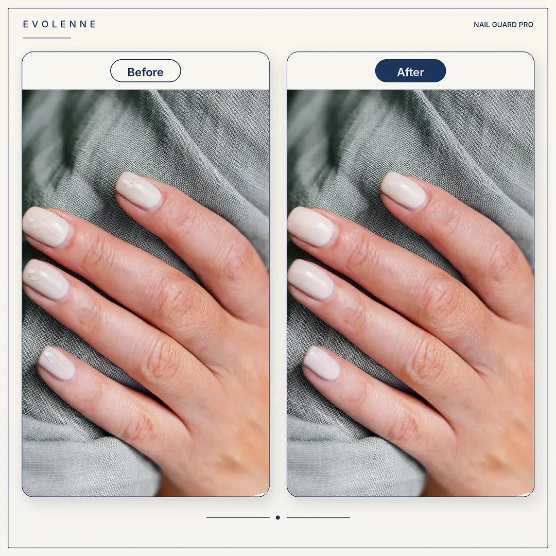 Nail Guard Pro